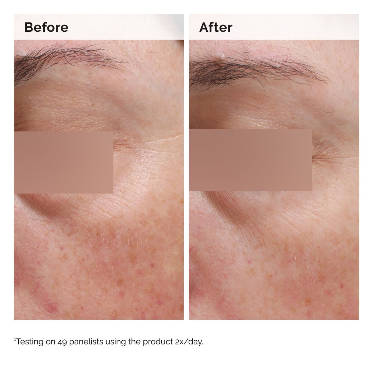 niacinamide-5-face-and-body-emulsion-q8 2024-08-23-ORD-Nia-5pct-Face-Body-B-A-Elasticity-Global-02-1x1.jpg