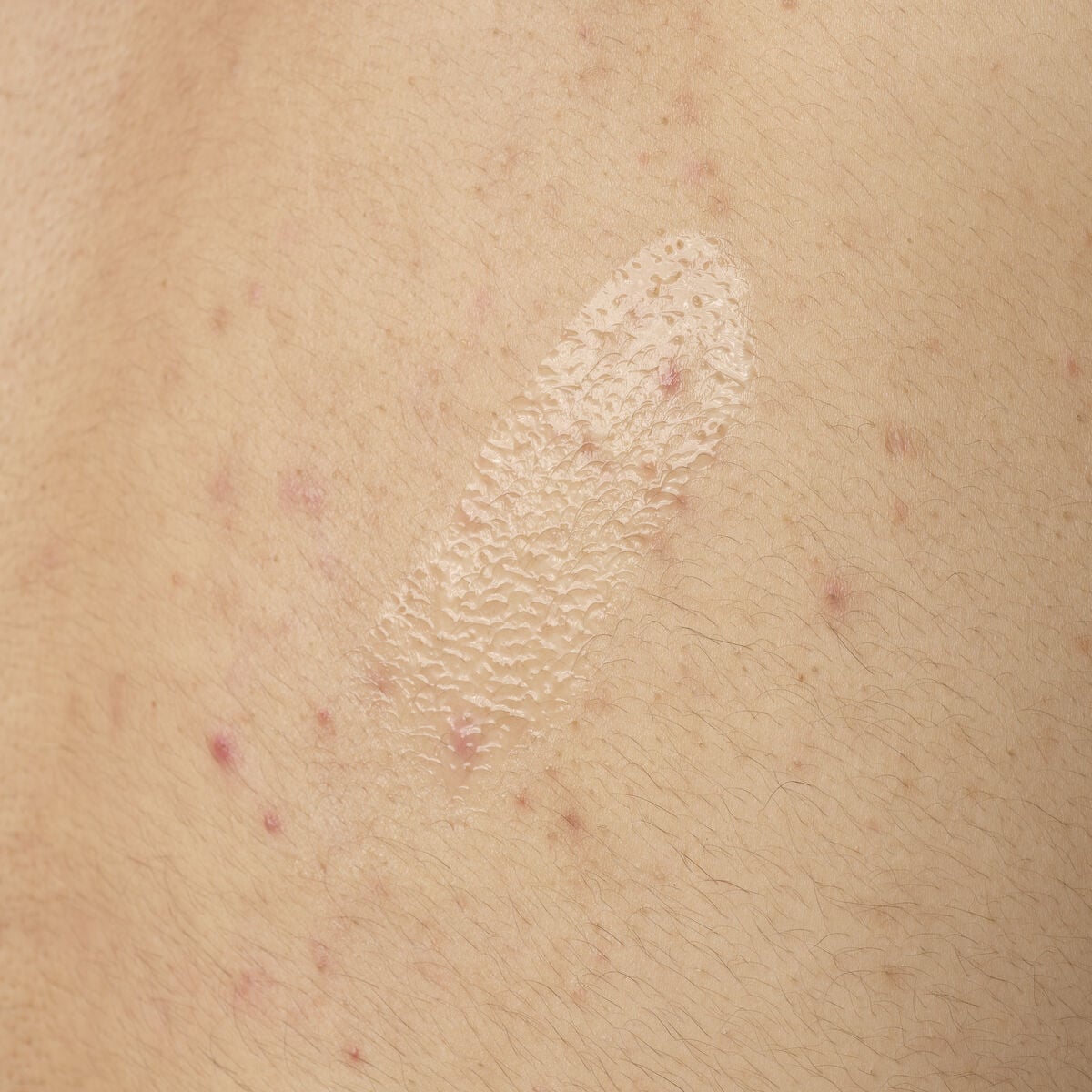 salicylic-acid-0-5-body-serum-h8 ORD-salicylic-acid-05-body-240ml-application.jpg