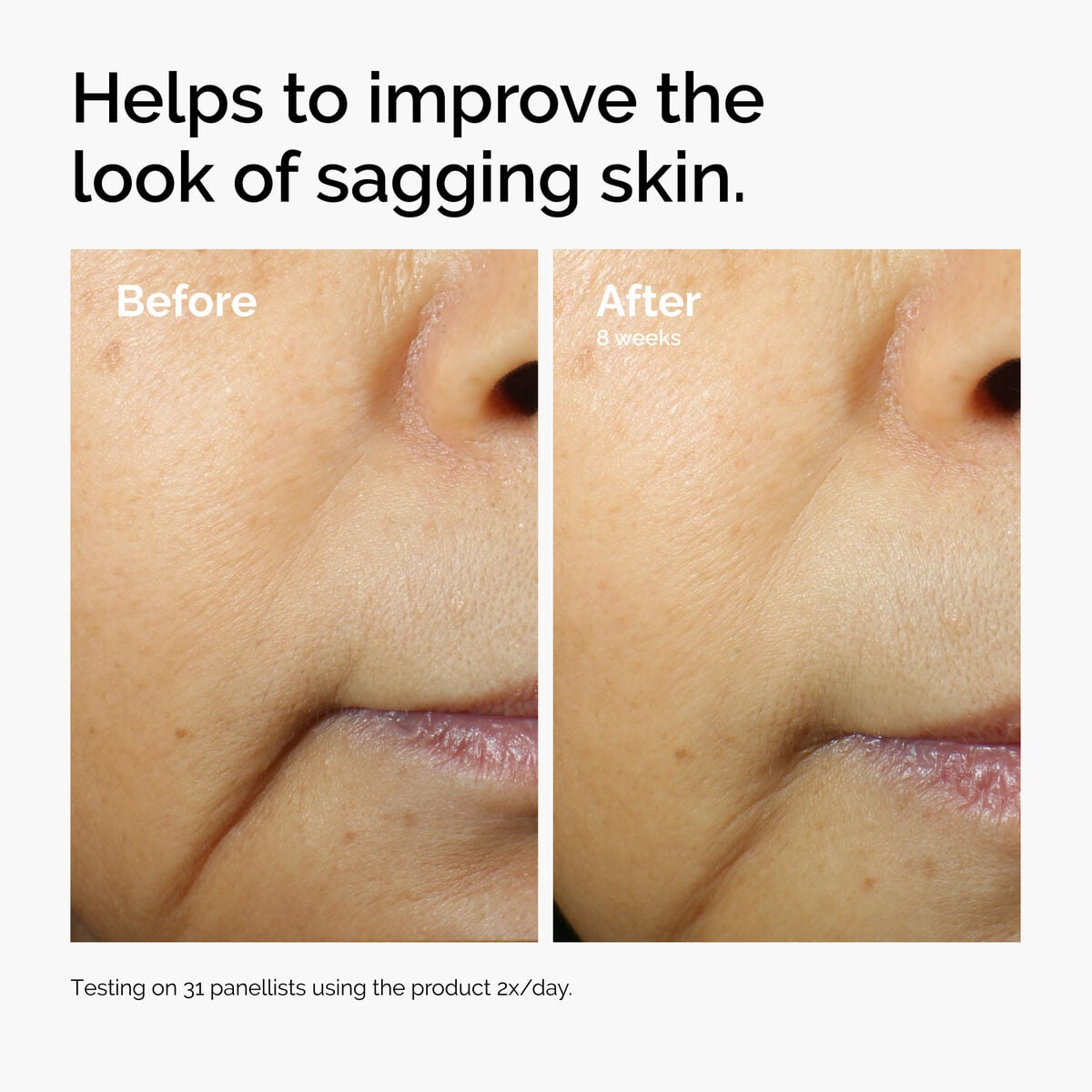 caffeine-3-escin-1-face-serum-m5 ord-caffeine-3pct-escin-1pct-face-serum-before-after-sagging.jpg
