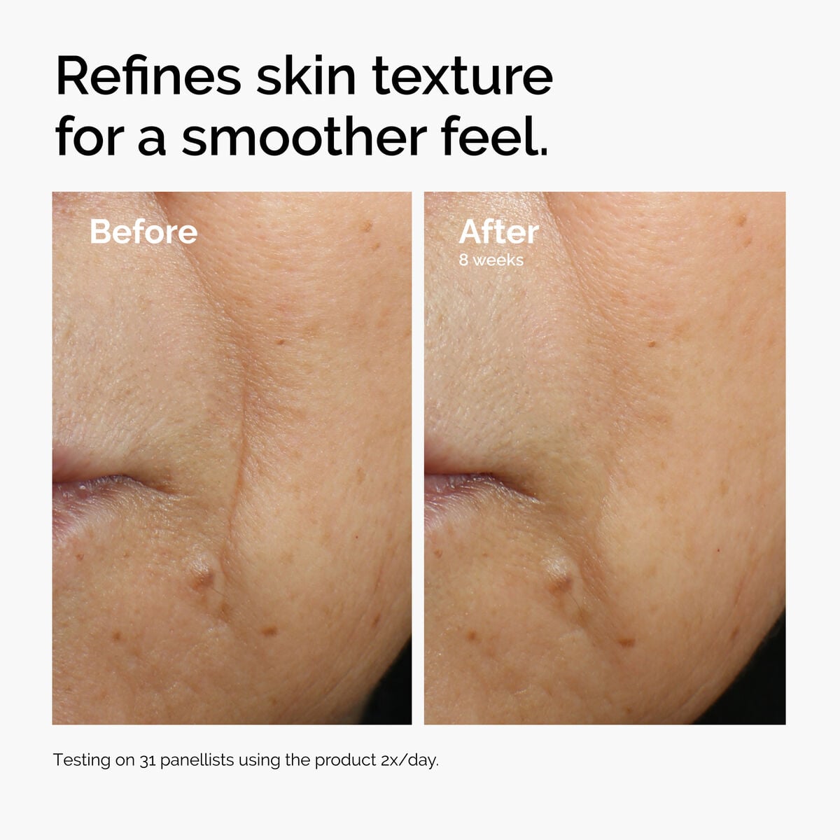 caffeine-3-escin-1-face-serum-m5 ord-caffeine-3pct-escin-1pct-face-serum-before-after-texture.jpg