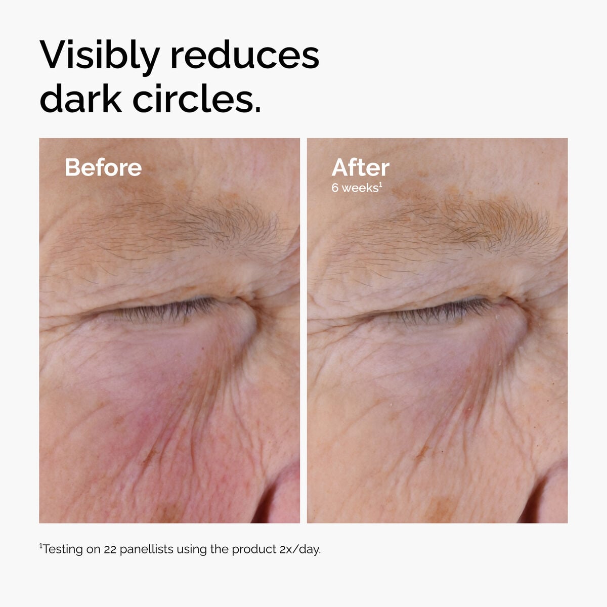 caffeine-solution-5-egcg-eye-serum-l5 ord-caffeine-solution-egcg-dark-circles-before-after.jpg