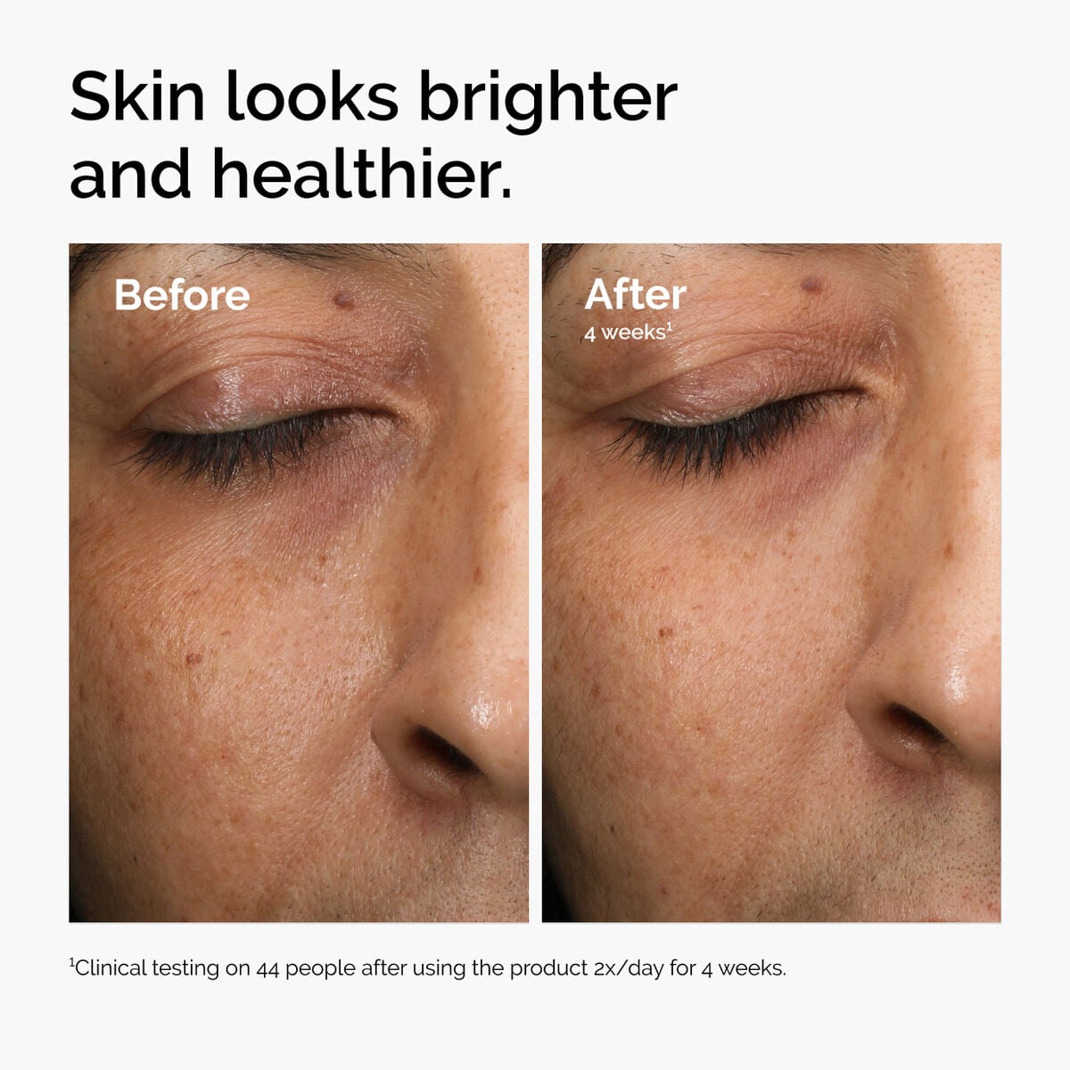 multi-antioxidant-radiance-serum-b5 ord-mars-before-after-healthy.jpg