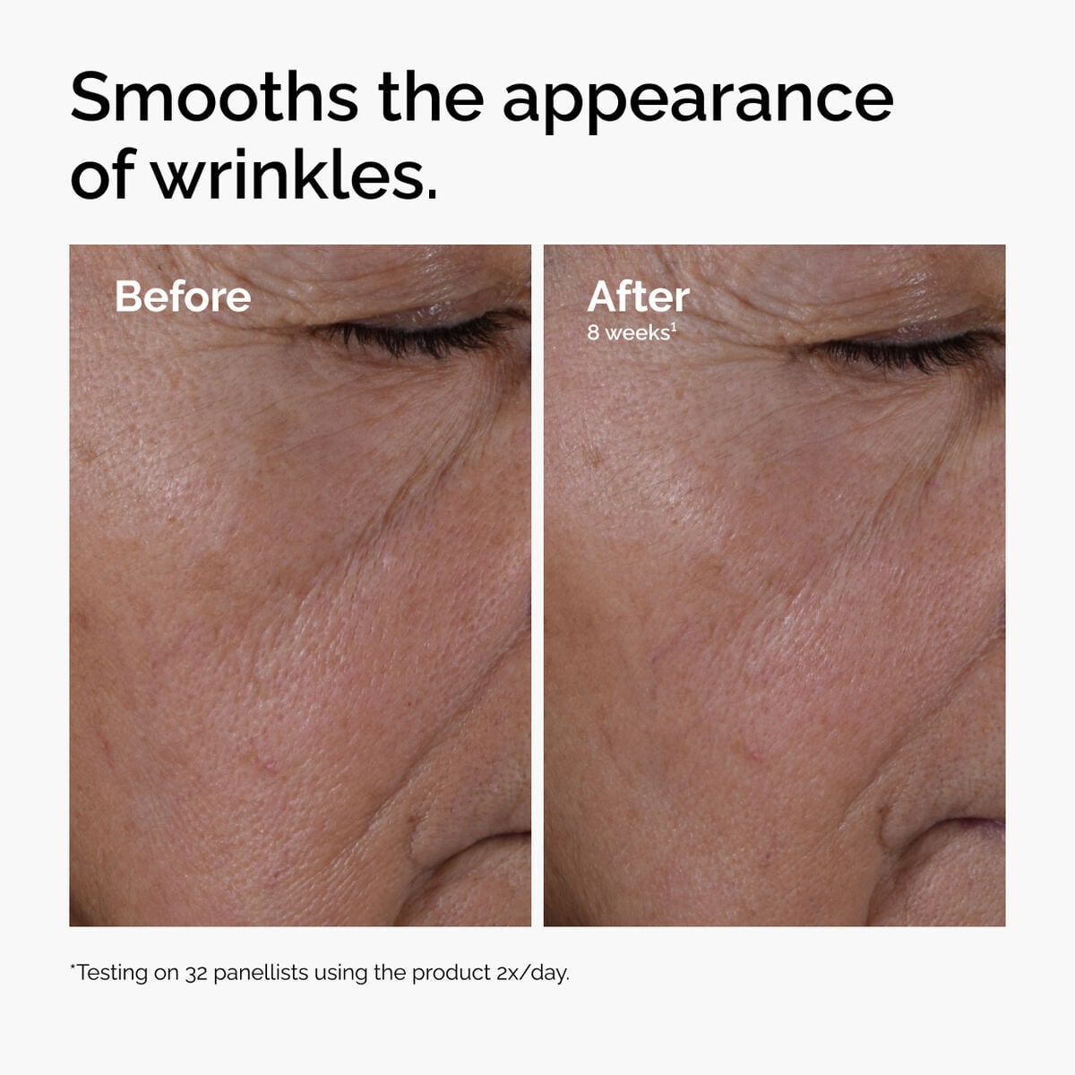 multi-peptide-ha-serum-l7 ord-multi-peptide-ha-serum-wrinkles-before-after.jpg