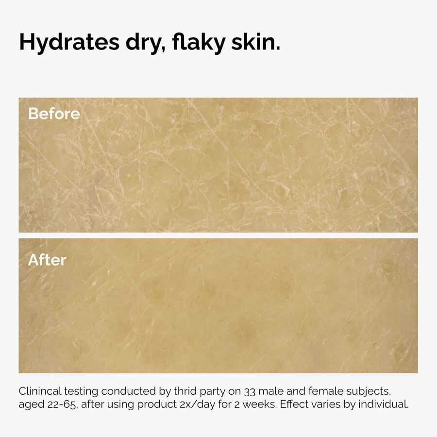 the-body-care-collection-m7 ord-natural-moisturizing-factors-inulin-body-before-after-graphic-02.jpg