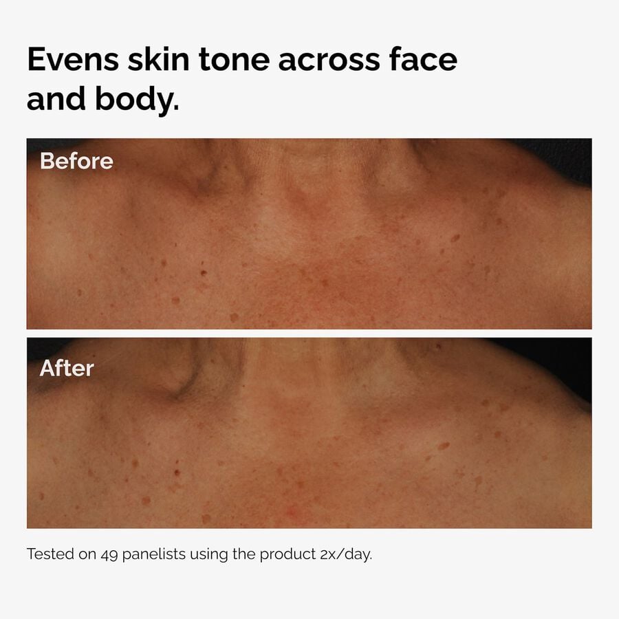 the-body-care-collection-m7 ord-niacinamide-face-body-serum-before-after-even-tone-graphic.jpg